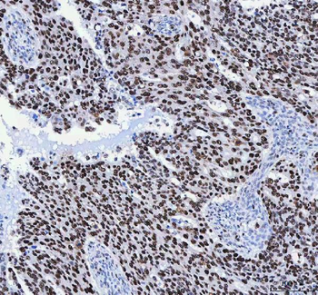 Anti-FEN1 Antibody