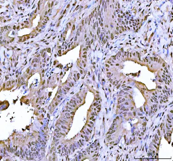 Anti-FEN1 Antibody