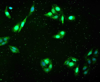 Anti-FHL FHL1 Antibody