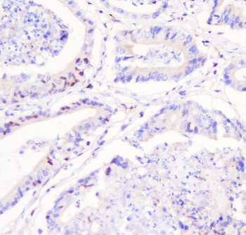 Anti-FHL FHL1 Antibody