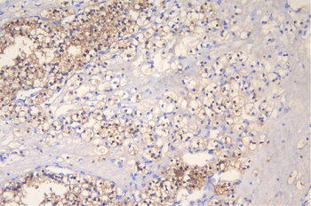Anti-FHL FHL1 Antibody