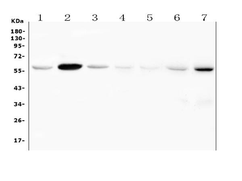 Fascin 2/FSCN2 Rabbit Polyclonal Antibody