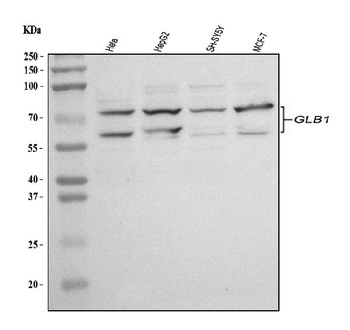 GLB1/Beta-galactosidase Antibody