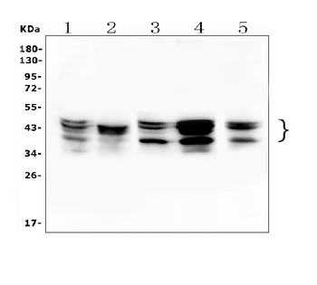 Anti-hnRNP D/AUF1/HNRNPD Antibody