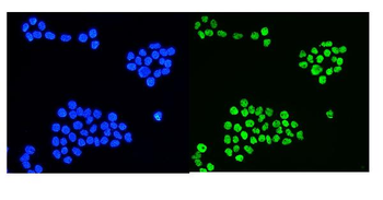 Anti-hnRNP D/AUF1/HNRNPD Antibody