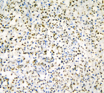 Anti-hnRNP D/AUF1/HNRNPD Antibody