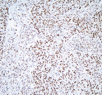 Anti-hnRNP D/AUF1/HNRNPD Antibody