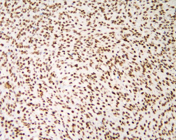 Anti-hnRNP D/AUF1/HNRNPD Antibody