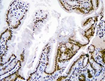 Anti-hnRNP D/AUF1/HNRNPD Antibody