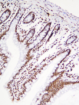 Anti-hnRNP D/AUF1/HNRNPD Antibody