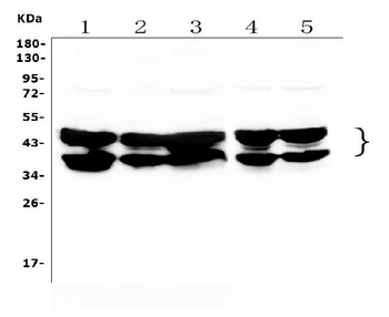 Anti-hnRNP D/AUF1/HNRNPD Antibody