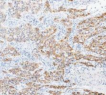 Anti-Cytokeratin 20/Krt20 Antibody