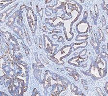 Anti-Cytokeratin 20/Krt20 Antibody