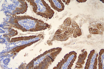 Anti-Cytokeratin 20/Krt20 Antibody