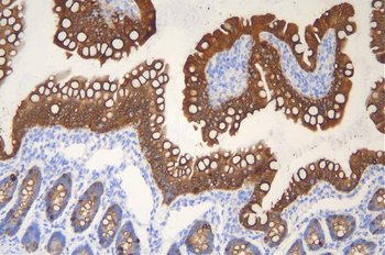 Anti-Cytokeratin 20/Krt20 Antibody