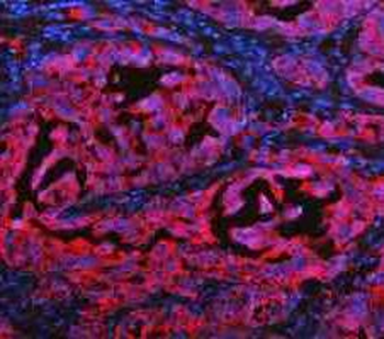 Anti-Cytokeratin 20/Krt20 Antibody