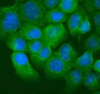 Anti-Cytokeratin 20/Krt20 Antibody