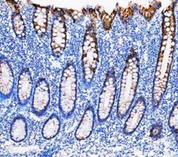 Anti-Cytokeratin 20/Krt20 Antibody