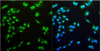 Anti-HEC1/HEC/NDC80 Antibody
