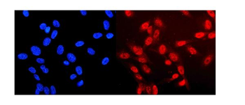 Anti-Neurofibromin/NF1 Antibody