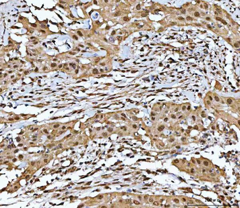 Anti-Neurofibromin/NF1 Antibody