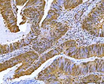 Anti-Neurofibromin/NF1 Antibody