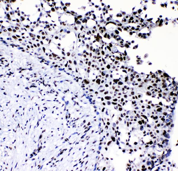 Anti-Neurofibromin/NF1 Antibody