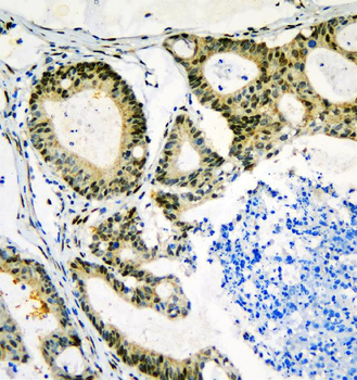 Anti-Neurofibromin/NF1 Antibody