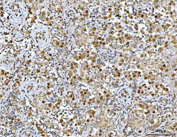 Anti-Neurofibromin/NF1 Antibody
