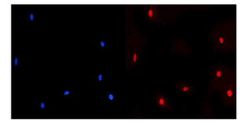 Anti-NUP214 Antibody