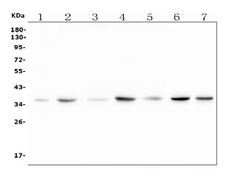 Anti-RTL10 Antibody