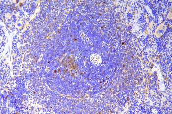 Anti-SCN11A Antibody
