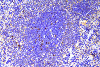 Anti-SCN11A Antibody