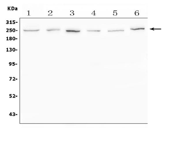 Anti-SCN11A Antibody