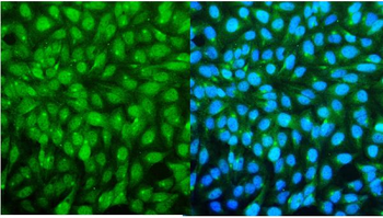 Anti-SMC4 Antibody