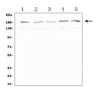 Anti-SMC4 Antibody