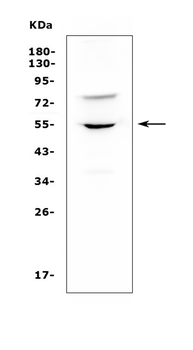 Anti-UGT1A6 Antibody