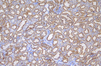 Anti-UGT1A6 Antibody