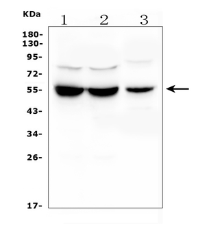 Anti-UGT1A6 Antibody