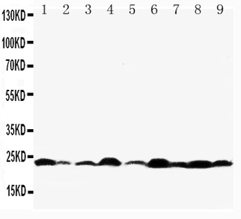 Apoptosis regulator BAX Bax Antibody