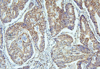SAE2/UBA2 Antibody (monoclonal, 5B13)