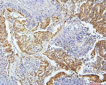 Anti-SAE2/UBA2 Antibody (monoclonal, 5B13)
