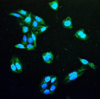 Anti-IDH1 Antibody (monoclonal, 16H7)