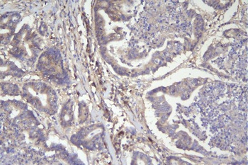 CD46 Antibody (monoclonal, 9E9)