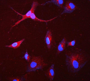 Anti-GAA Antibody (monoclonal, 2G7)