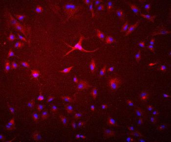 GAA Antibody (monoclonal, 2G7)