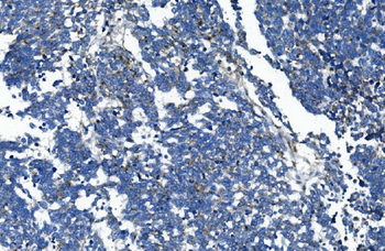 Anti-GAA Antibody (monoclonal, 2G7)