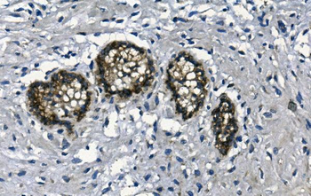 Anti-GAA Antibody (monoclonal, 2G7)