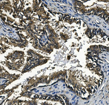 Anti-GAA Antibody (monoclonal, 2G7)