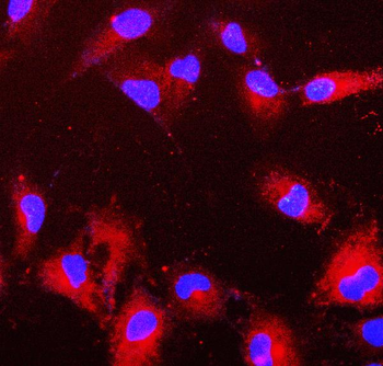 Anti-PRDX6 Antibody (monoclonal, 6I8)